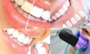 Diş Parlatma: Sağlıklı ve Parlak Gülüşler İçin Önemli Bir Adım